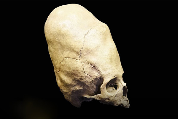 Bí ẩn những hộp sọ kéo dài có niên đại hơn nghìn năm về trước