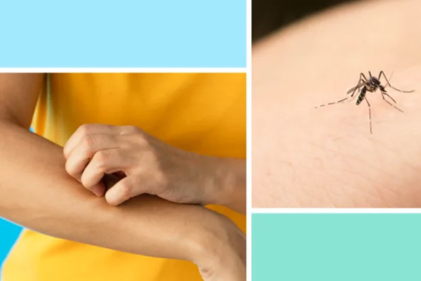 Loài cướp đi sinh mạng của nhiều người nhất mỗi năm