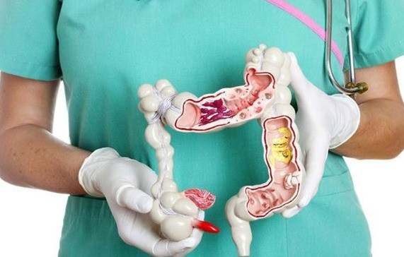 Dấu hiệu bất thường chỉ ra nguy cơ mắc ung thư đại trực tràng