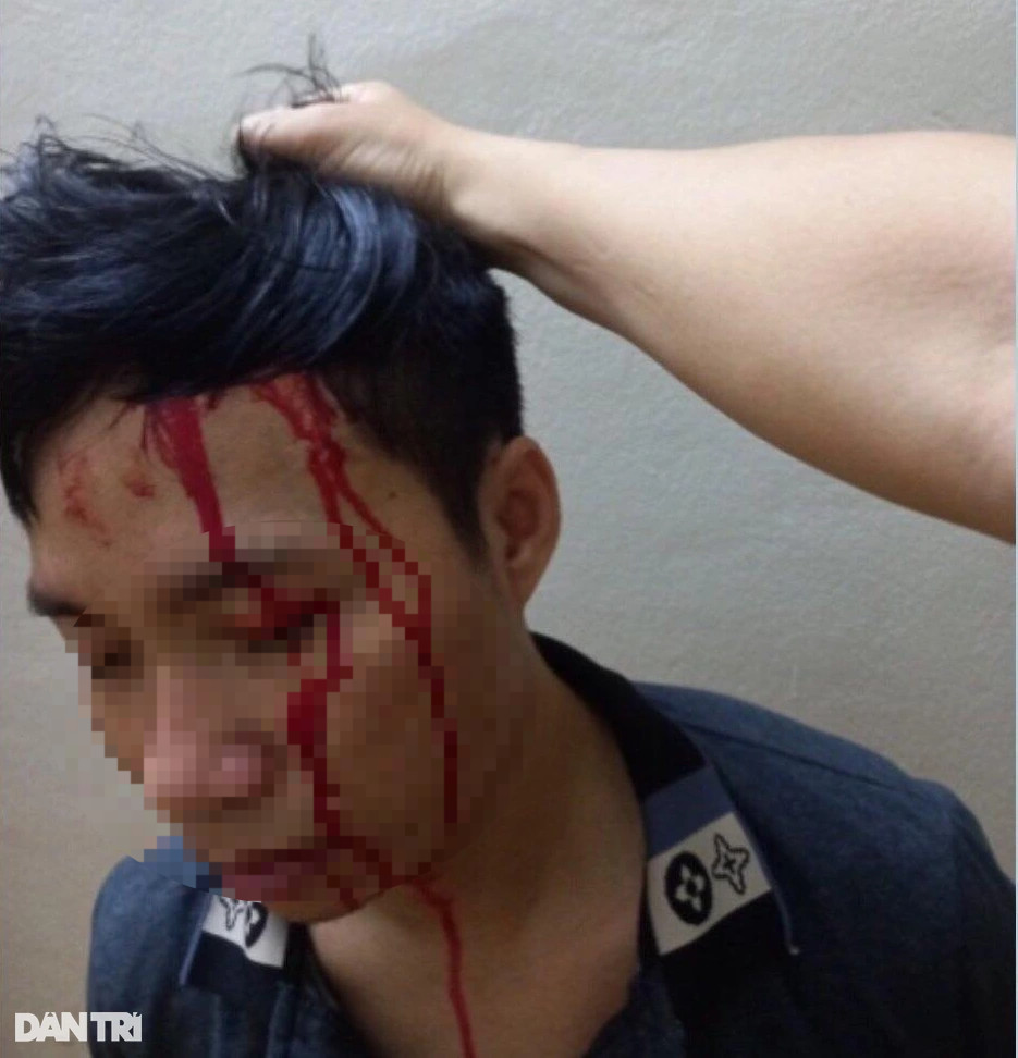 Con trai mua tiết lợn dàn dựng bị bắt cóc để tống tiền mẹ - 1