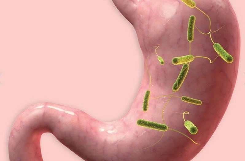 Mới 15 tuổi, trẻ đã viêm loét dạ dày phải cấp cứu