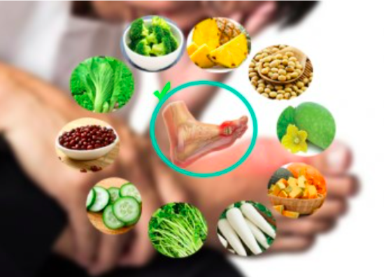 Thực phẩm người bị gout nên tránh có nhiều tên quen thuộc