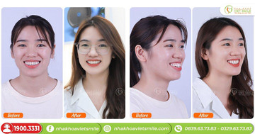 Nha khoa Viet Smile liên tục cập nhật kỹ thuật hiện đại