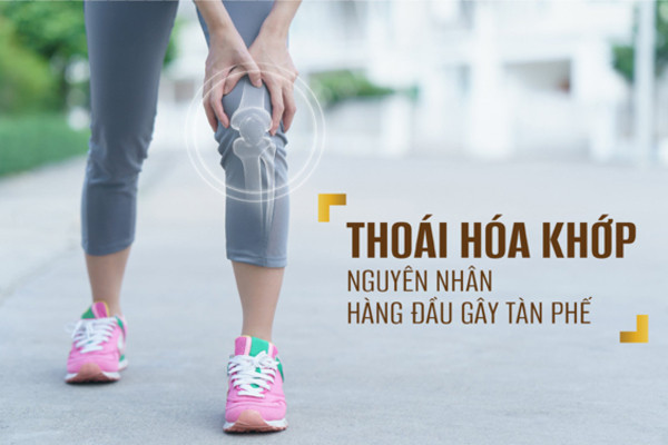 Giải pháp hỗ trợ bảo vệ xương khớp cho người thoái hóa khớp