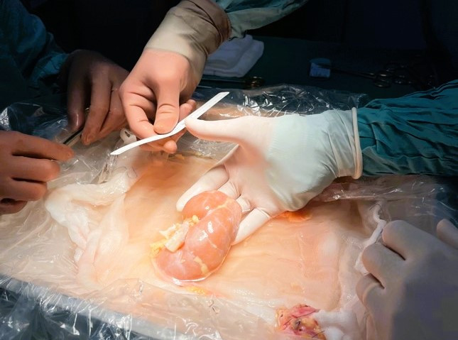 Cô gái trẻ thay đổi cuộc đời cậu bé 15 tuổi dù chưa từng gặp mặt