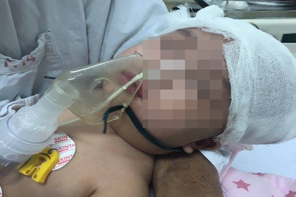 Bắt khẩn cấp bảo mẫu bạo hành bé trai 6 tháng tuổi tổn thương não nặng