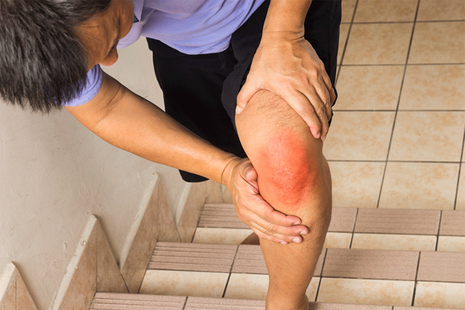 Đau nhức xương khớp - căn bệnh ‘dự báo thời tiết’ oái ăm
