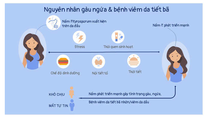 3 cách gội đầu cải thiện gàu ngứa tại nhà