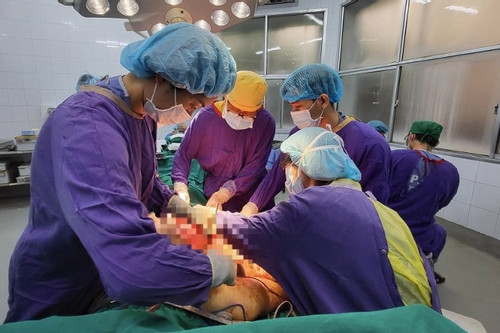 30 bác sĩ hợp sức cứu người đàn ông có khối u nguy cơ vỡ tung