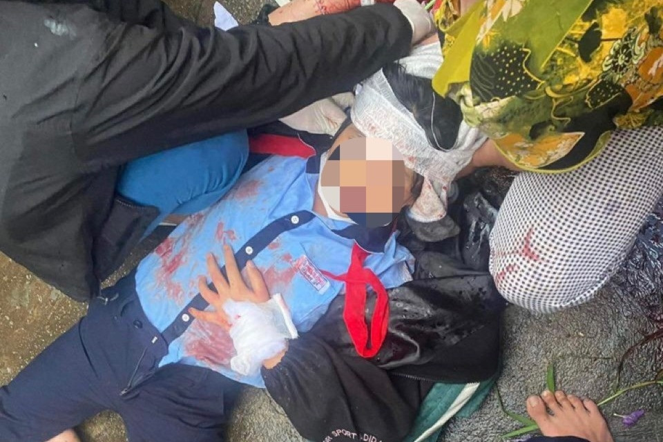 Nữ sinh lớp 6 bị hàng xóm dùng búa đánh chấn thương khi vừa tan học