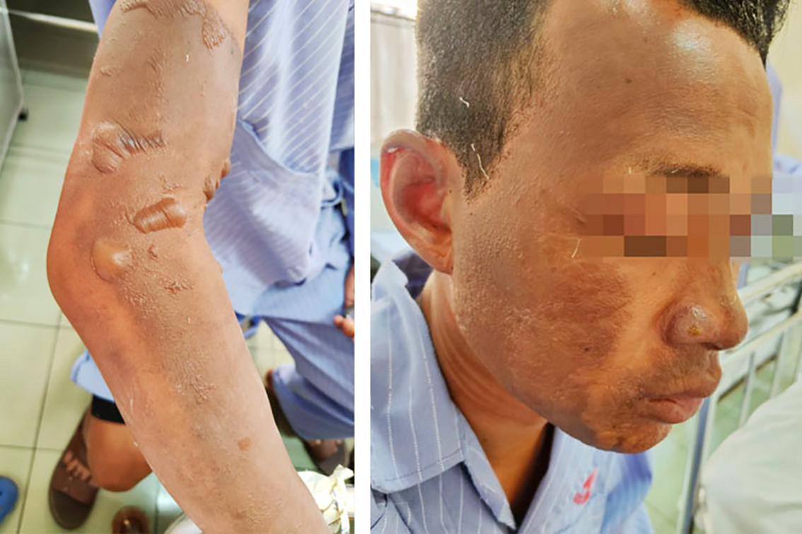 w f bong xang do do rac.jpeg