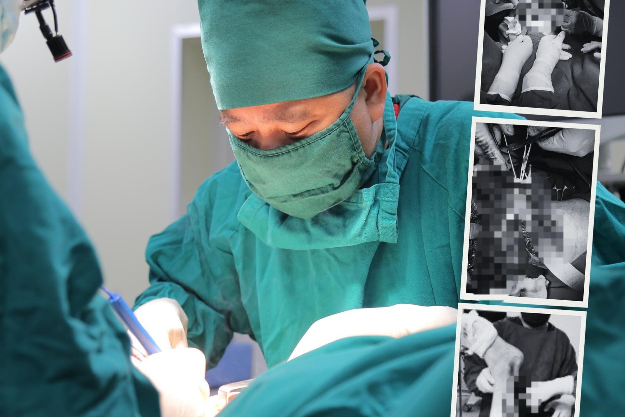 Bật báo động đỏ cứu người đàn ông bị chém gần lìa cẳng chân