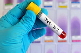 Sai lầm gây hậu quả nghiêm trọng khi tắm bồn nước nóng mùa đông Bác sĩ bị tố bí mật dùng tinh trùng của mình thụ thai cho bệnh nhân