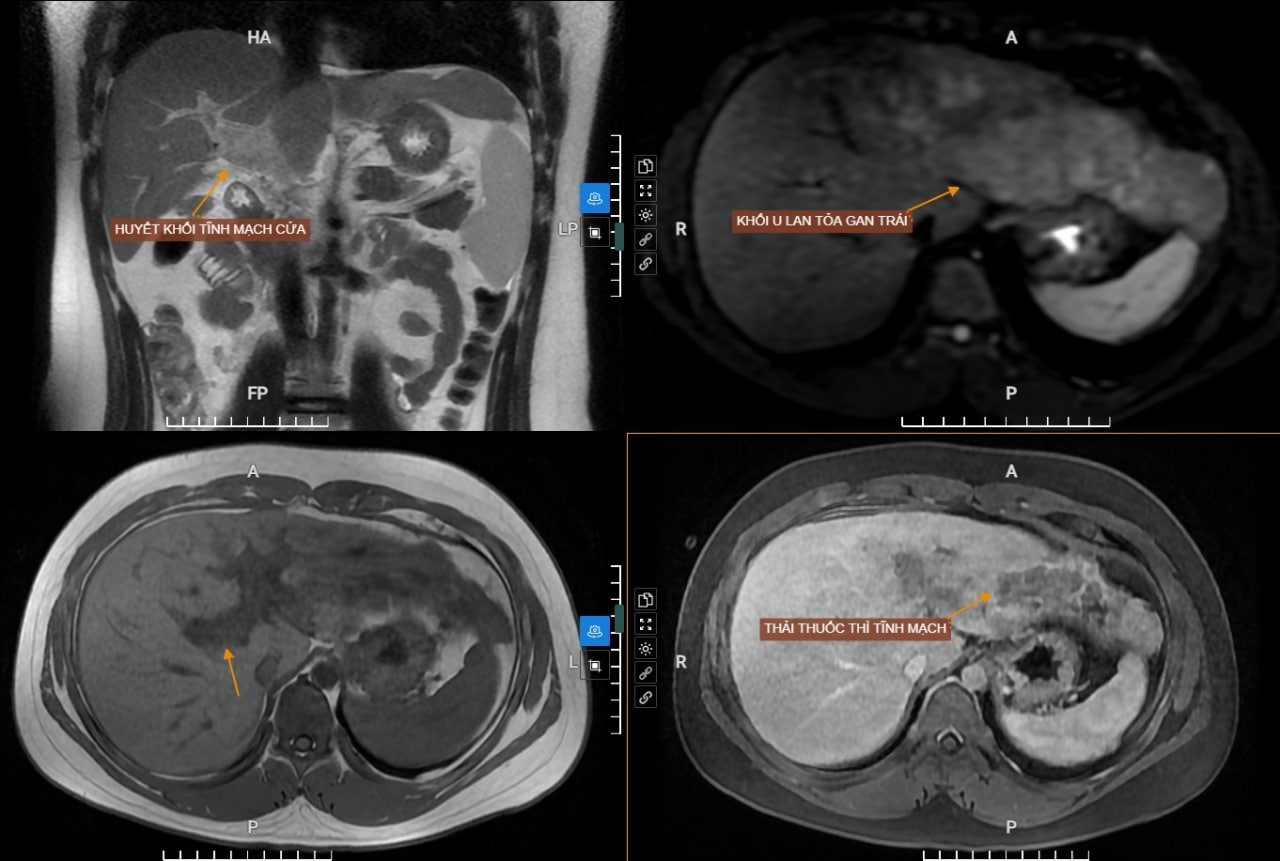 1 166dc3a d104 445b b5bb 1f7e578d4718.jpg