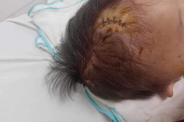 Truy tìm người tông xe khiến cháu bé 2 tuổi bị chấn thương sọ não