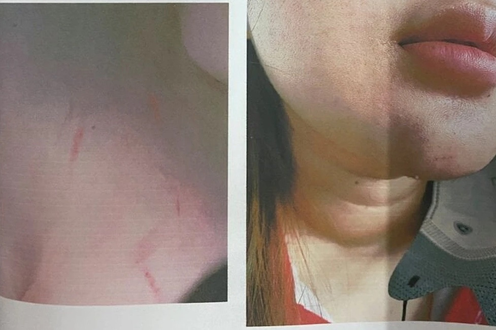 Con và bạn mẫu thuẫn, mẹ tìm đến nơi ở giải quyết khiến 1 học sinh bị thương