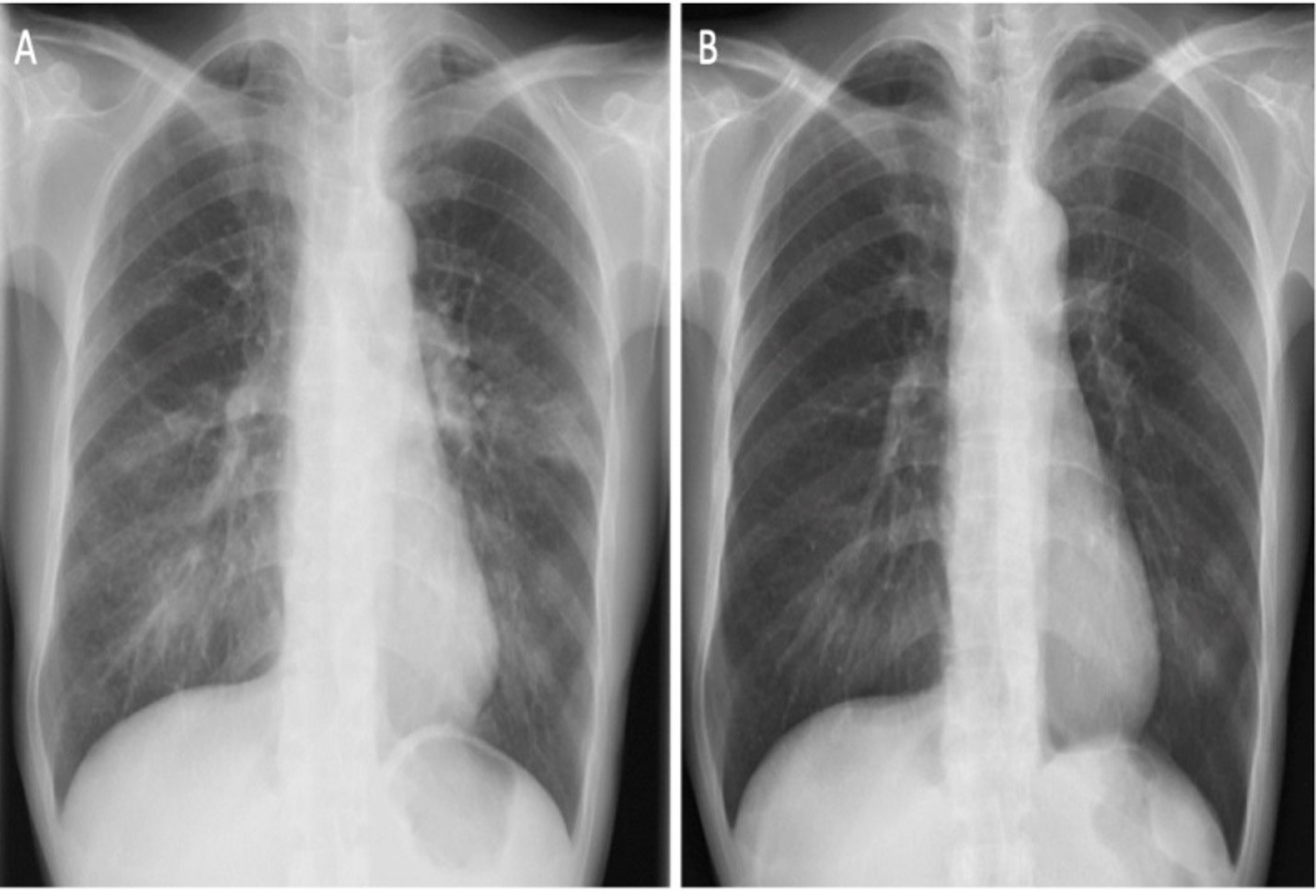 thuốc lá điện tử 1.jpg