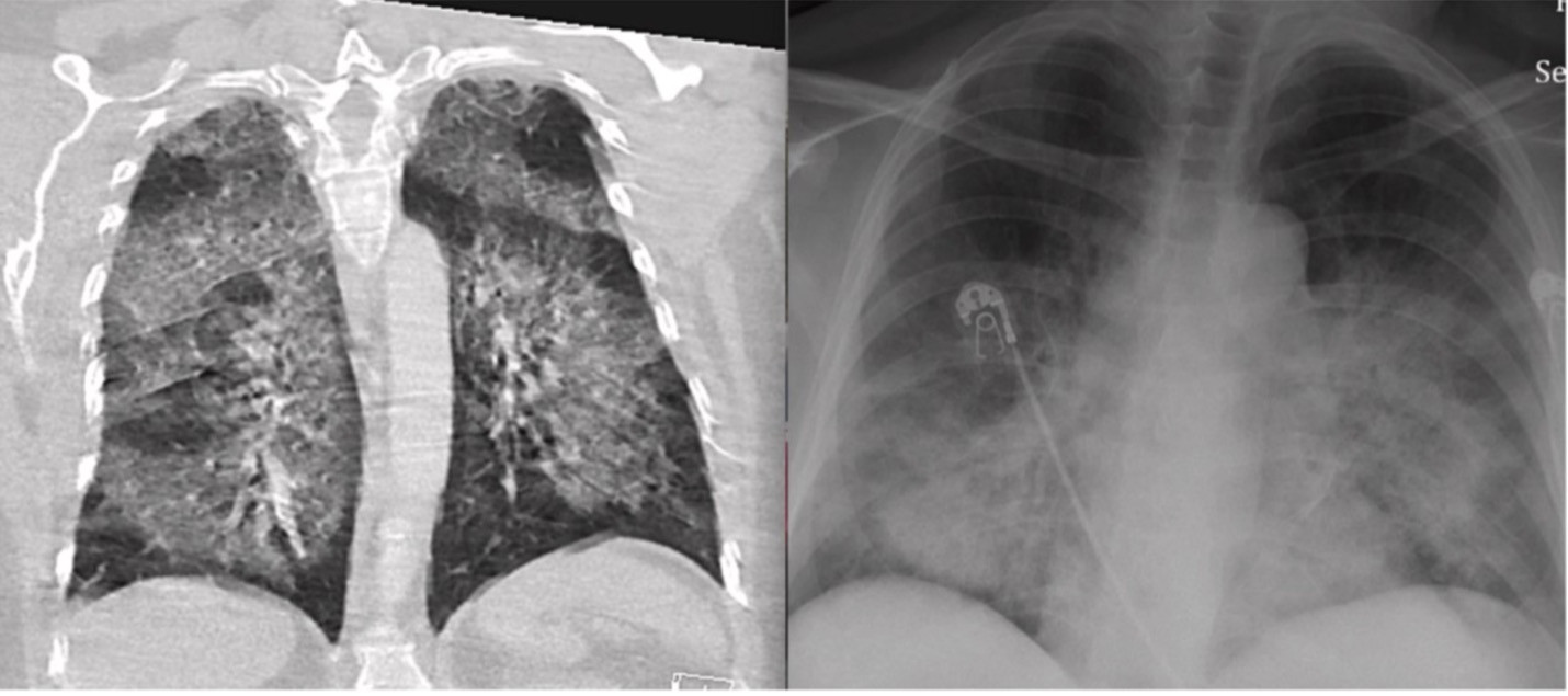 thuốc lá điện tử who.jpg