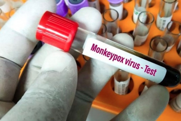 Dong Nai province logs second monkeypox infection