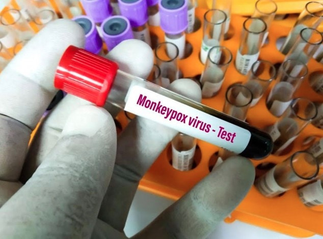 southern bien hoa city logs second monkeypox infection picture 1