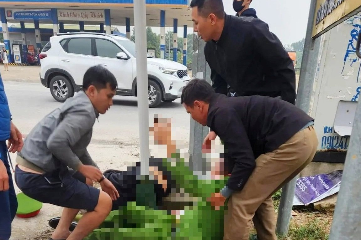 Thiếu tá công an bị xe máy gặp tai nạn văng gãy xương đùi