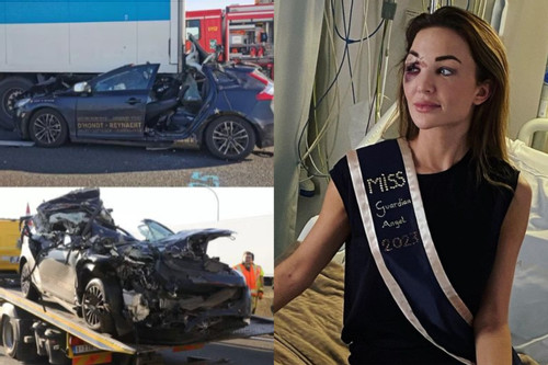 Mặt hoa hậu Bỉ biến dạng sau tai nạn giao thông nghiêm trọng