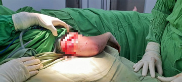 Dog that attacked British tourist in Nha Trang put down