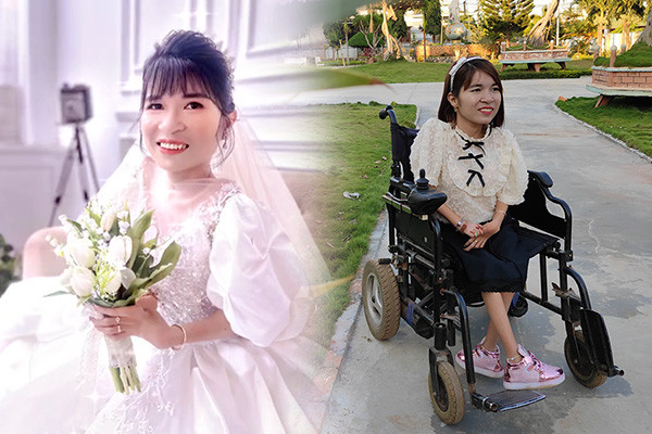 Cô gái bị dị tật bẩm sinh gây xúc động về đám cưới trong mơ