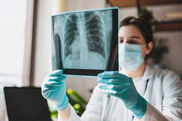 Chuyên gia cảnh báo nhóm người cần tầm soát ung thư phổi