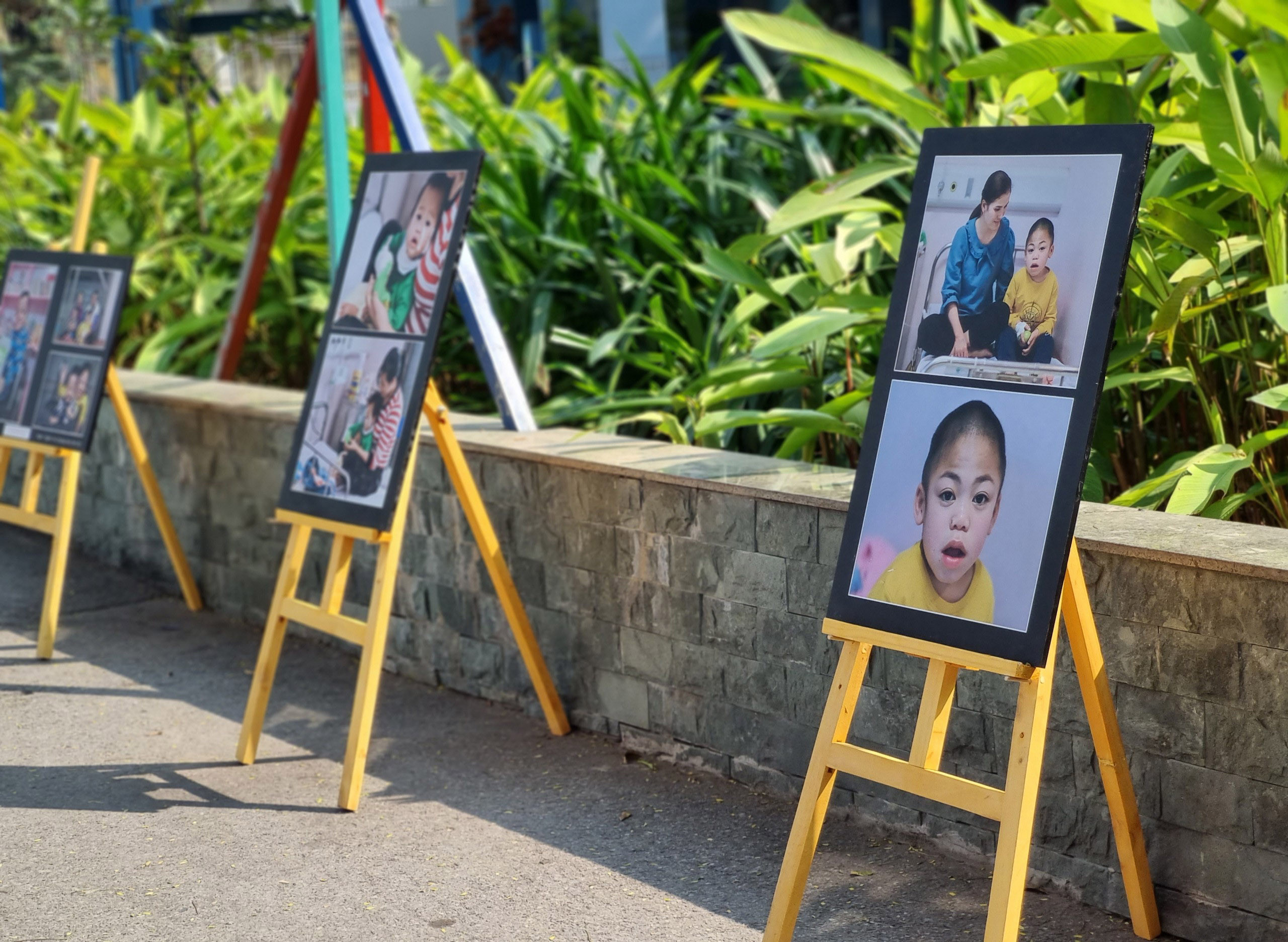 Bệnh hiếm 30 lần đến viện mới có thể chẩn đoán