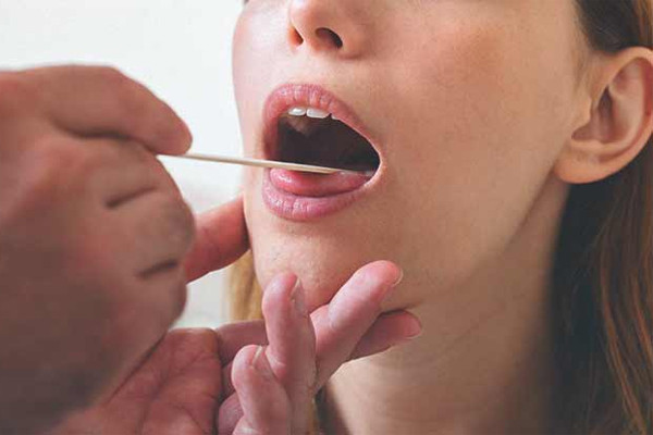 Người phụ nữ phát hiện ung thư nhờ bất thường ở lưỡi