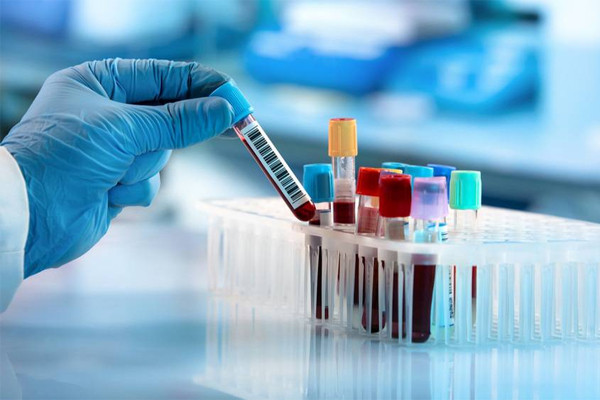 Người phụ nữ phải cắt bỏ chân và ngón tay sau triệu chứng giống cúm