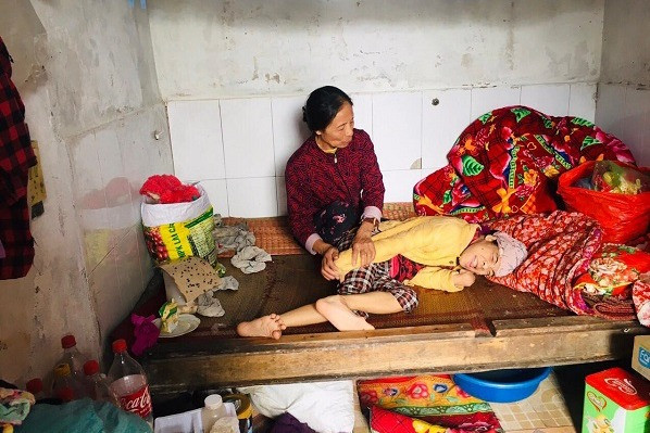 Hơn 40 năm chăm con gái bại não bẩm sinh, cha mẹ nghèo kiệt quệ