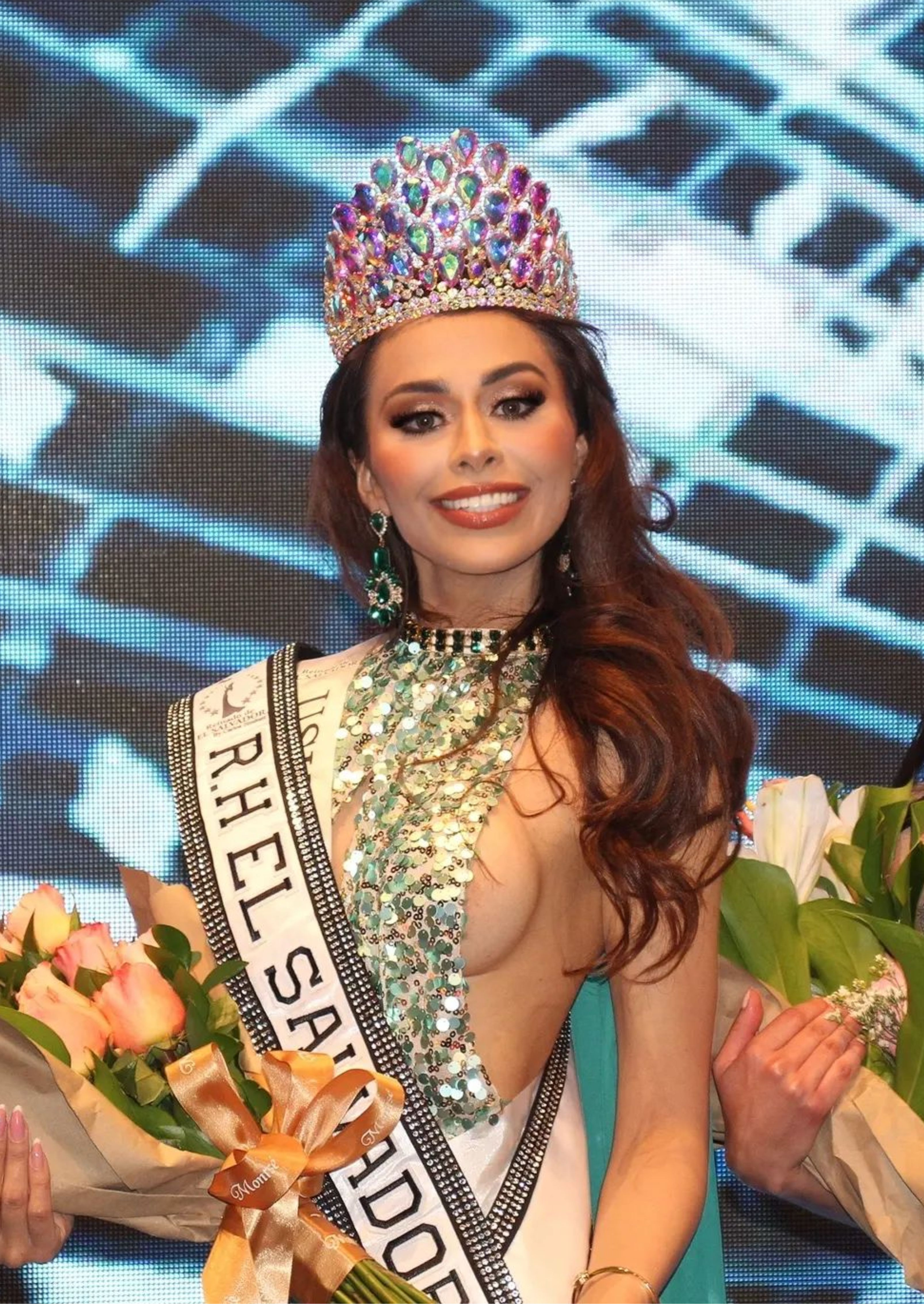 Hoa hậu El Salvador nhập viện cấp cứu vì bị gãy chân
