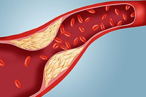 Cà gai leo Thảo dược quý có nhiều công dụng nhưng không phải ai cũng nên dùng Cà gai leo Thảo dược quý có nhiều công dụng nhưng không phải ai cũng nên dùng