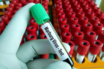 Bộ Y tế yêu cầu giám sát chặt nguồn lây nhiễm virus Marburg