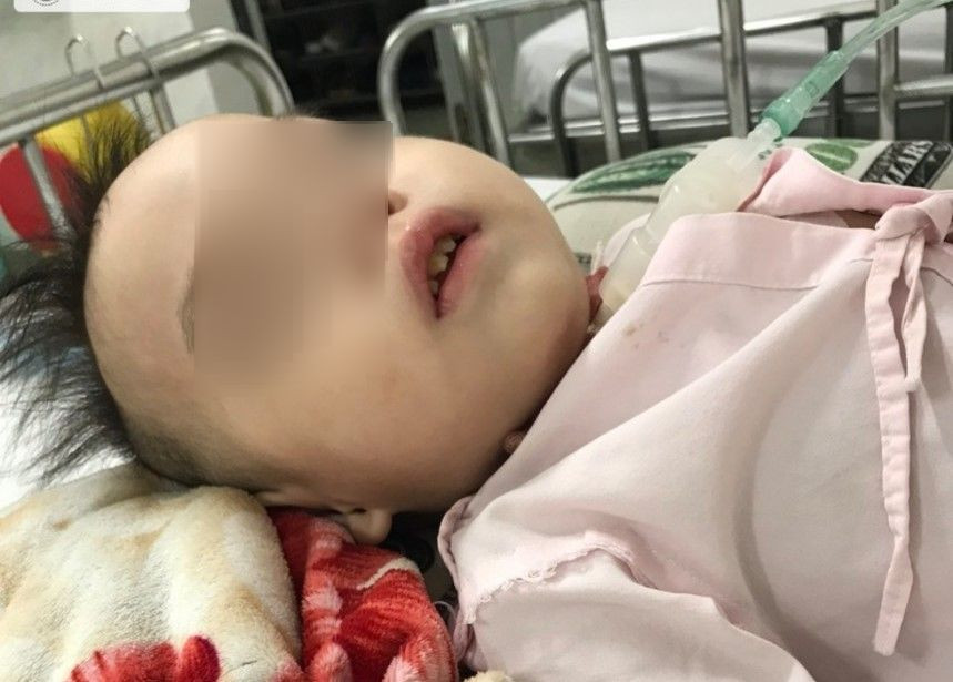 Vụ trẻ đột ngột hôn mê ở TP.HCM: Bệnh viện không đồng ý cung cấp hình ảnh camera