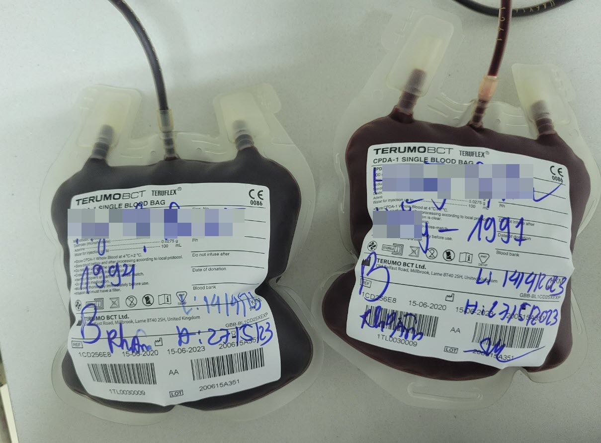 5 người hiến máu cực hiếm cứu sản phụ nguy kịch sau sinh