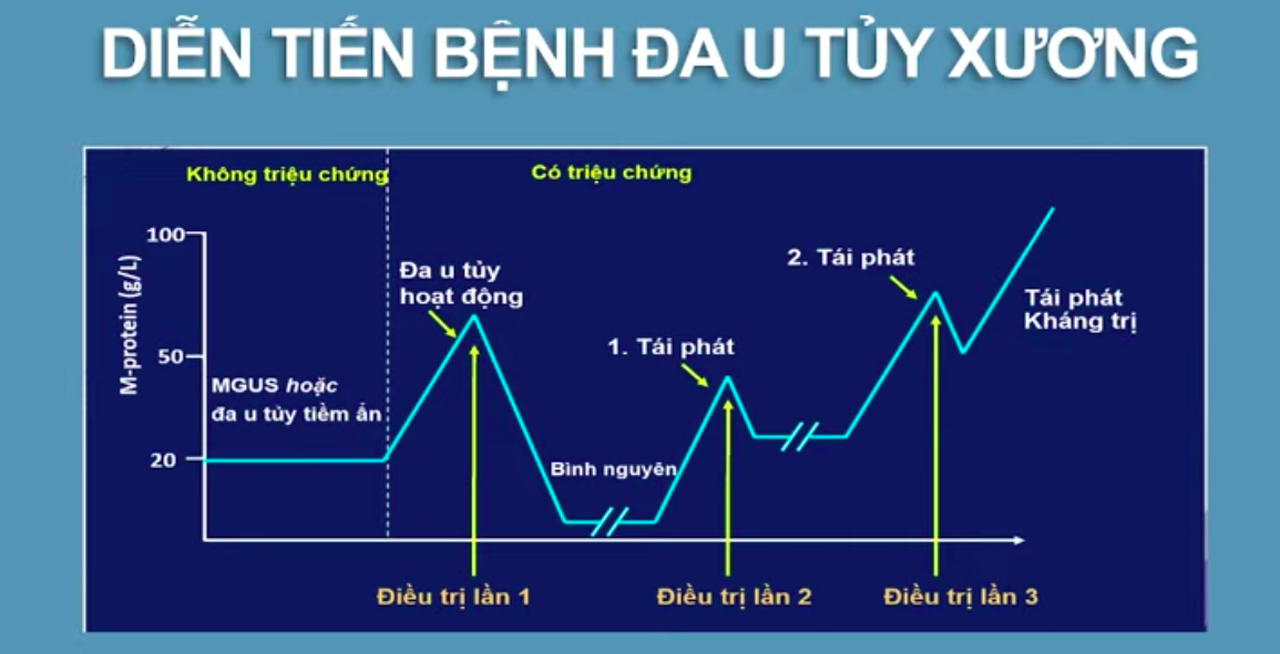 Q&A: Dấu hiệu đau thắt lưng lưng cảnh báo bệnh đa u tủy xương