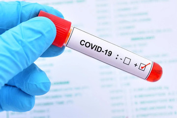 Triệu chứng Covid-19 ở Việt Nam giống hệt cảm cúm