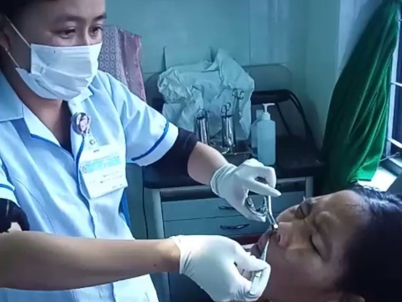 Liên tục chảy máu cam, người phụ nữ phát hiện đỉa trong mũi