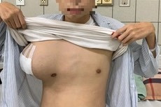 Nam sinh 16 tuổi mang khối u khổng lồ ở ngực