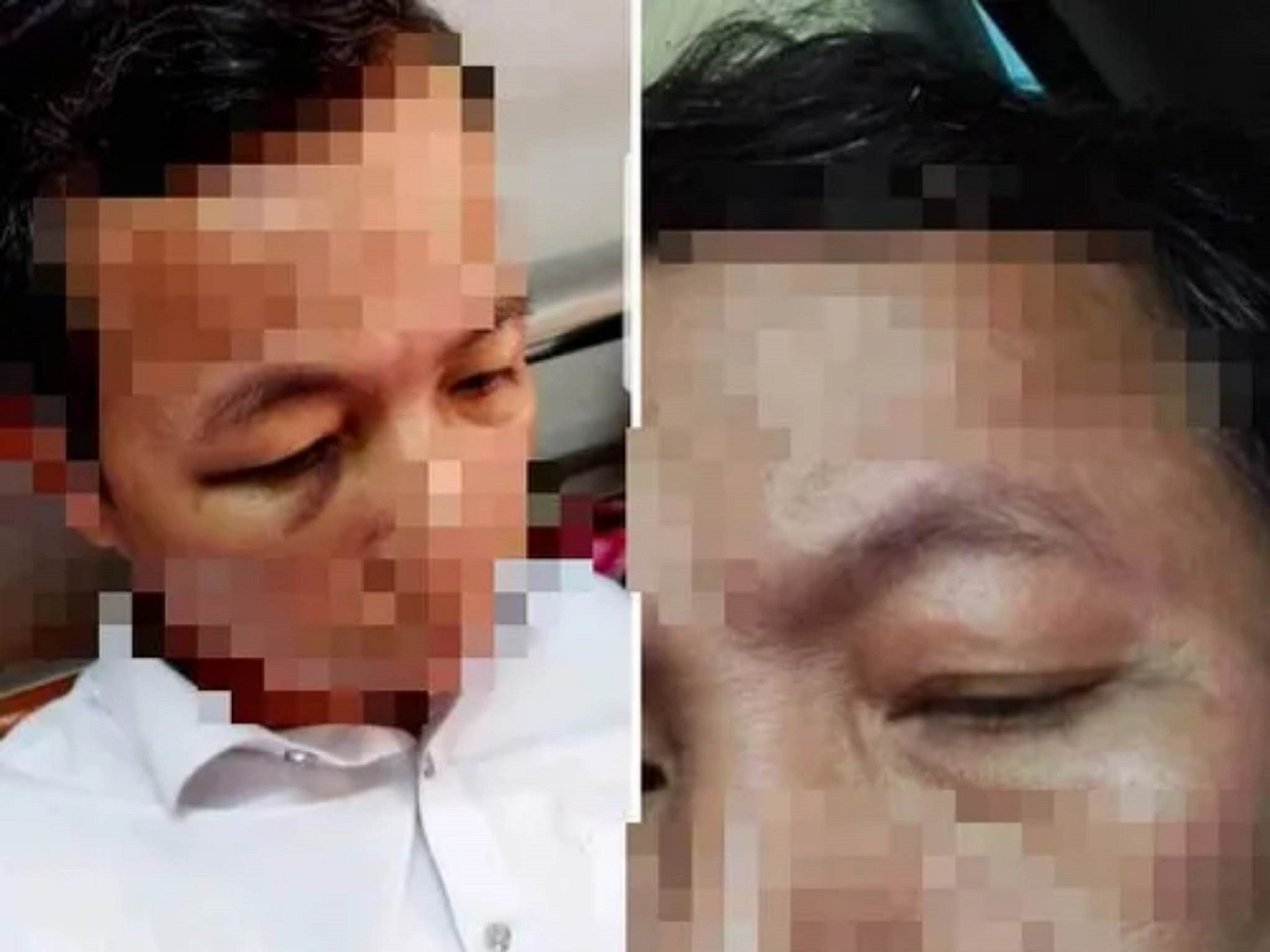 Hiệu trưởng đánh hiệu phó phải nhập viện vì chuyện mở cổng trường