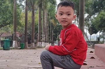Bé trai 5 tuổi bị bỏng cồn nguy kịch