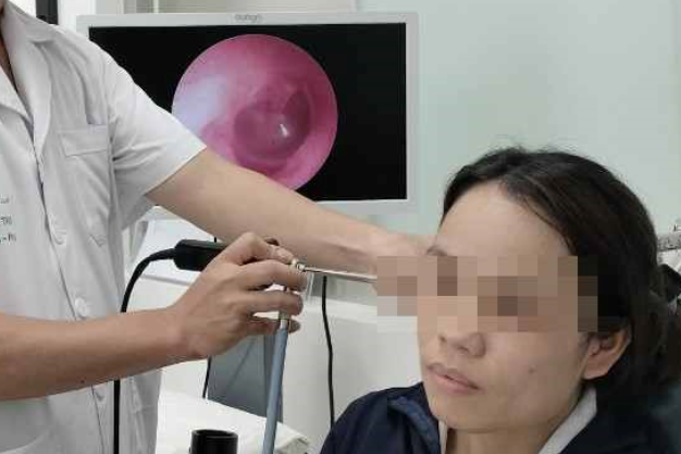 Mối nghi ngờ của bác sĩ giải thoát cô gái Hà Nội khỏi cảnh đau đầu, chảy mủ tai