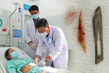 Người phụ nữ bị xương cá rô phi xuyên thủng thực quản và động mạch chủ ngực