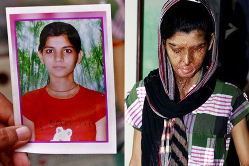 Câu chuyện vượt lên số phận của những người phụ nữ bị tạt axit ở Ấn Độ
