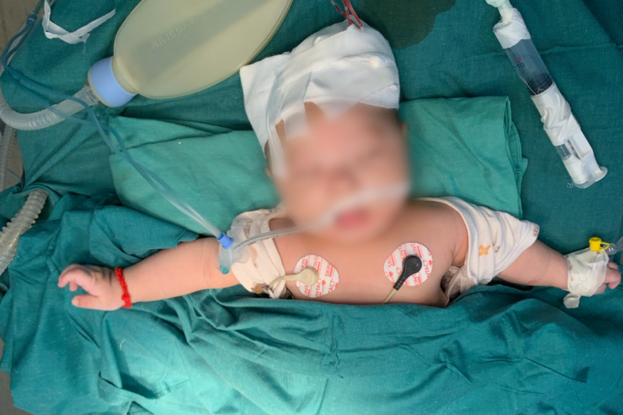 Trượt cát khi đi xe máy với bố mẹ, con bị ngã lún sọ