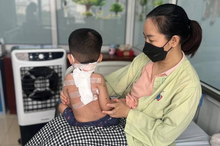 Phát hiện mắc bệnh hiếm từ mảng da màu đen ở lưng