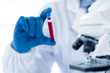 Phương pháp xét nghiệm máu có thể phát hiện sớm hơn 50 loại ung thư